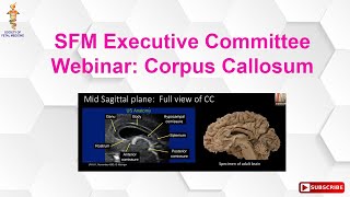 SFM Executive Committee Webinar Corpus Callosum [upl. by Alviani]