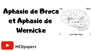 💡Aphasie de Broca et aphasie de Wernicke ❓ [upl. by Yand740]