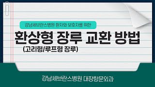 환상형고리형 루프형 장루 교환 방법 안내ㅣ강남세브란스병원 대장항문외과 [upl. by Anoed]