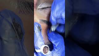 Microblading procedure  Complete Guide by Muskan Tyagi Dermalyn Aesthetics  CEOFounder [upl. by Margette]