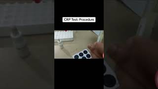 CRP Test Procedure 🩸 [upl. by Dollie601]