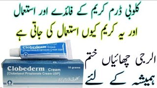 Clobederm cream uses in urdu ClobetasolBenefits I How to apply  Side effectscream [upl. by Allison]