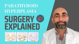 Parathyroid hyperplasia surgery explained [upl. by Elimay]