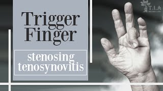 trigger finger and trigger thumb stenosing tenosynovitis [upl. by Adnovad]