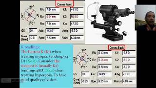 لأطباء العيون Pentacam1 [upl. by Crescin]