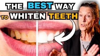 The BEST Way to Whiten Your Teeth without ruining them [upl. by Eidnalem610]