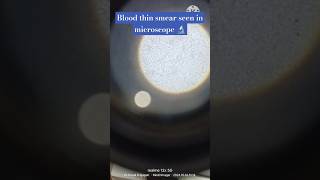 Blood microscopic test microscopebloodsliderbcwbcplateletspalamujharkhandpathologymltbmlt [upl. by Eedeed58]