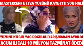 Masterchef Beyzanın Yüzüne Kızgın Yağ Döküldü Son Hali Acun Ilıcalı Tazminat BEYZA YARIŞMADAN ELENDİ [upl. by Feingold483]