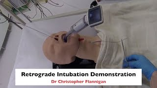 Retrograde Intubation Demonstration [upl. by Ahtar]