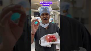 Either Baby or Fibroid  pregnant baby fibroidremoval babybirth uterus 8yearwait [upl. by Nerag]