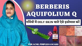 Berberis Aquifolium Q  Best Way to use for OILY SKIN in summers  Get glowing skin Instantly [upl. by Lieberman]