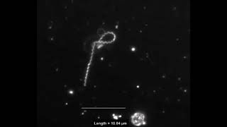 Interaction of Treponema pallidum the syphilis spirochete with human platelets [upl. by Eatnoled]