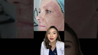 PLASMA PEN BISA UNTUK ANTI AGING plasmapen aestheticdoctor skincaretips skincare skintips [upl. by Belva]