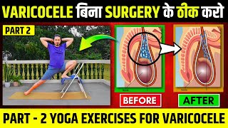 बिना SURGERY के VARICOCELE ठीक करे 🔥। Best Yoga To Cure VARICOCELE At Home  PART 2 [upl. by Susanna]