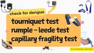 Tourniquet test  Capillary Fragility Test  RumpelLeede Test  Petechia  simple explanation [upl. by Teodoor281]