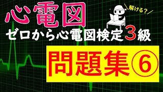 問題集⑥ ゼロから心電図検定4級3級 [upl. by Rior]