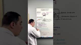 Ischemic Stroke  Lacunar Infarct shorts [upl. by Telocin]