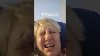 FND seizure aka non epileptic seizure functional neurological disorder [upl. by Nailuj381]