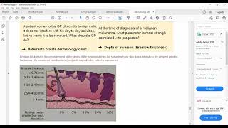 Plab 1 Lecturers Dermatology Part 13 Skin CancersDermal Melanosis XanthlaesmaLipomaParonachya [upl. by Rutger]