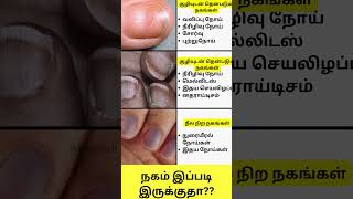 நகம் இப்படி இருக்குதா Nail Disorders in Tamil Shorts intamizh [upl. by Ayotel]