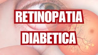 RETINOPATIA DIABETICA SIGNOS Y SINTOMAS  ¿CUAL ES EL TRATAMIENTO [upl. by Kali509]