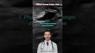 Breast Duct Dilatation Differential Diagnoses radiology [upl. by Tirzah]