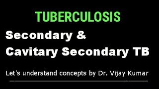 Secondary Pulmonary TB  Pulmonary TB  Secondary TB  Tuberculous Infection  Pathology Lectures [upl. by Anelra]