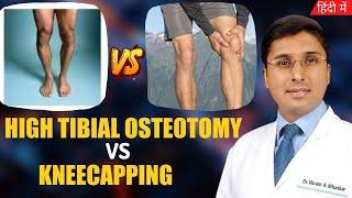 Difference Between High Tibial Osteotomy Vs Kneecapping  Hindi  Partial Knee Replacement Surgery [upl. by Ellinnet]