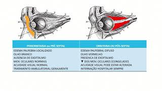 Diferenças entre celulite periorbitária préseptal de celulite orbitária  pósseptal [upl. by Eedoj]