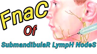 Fineneedle Aspiration cytology of Submandibular Lymph Nodes।। [upl. by Giustino12]