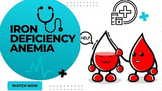 Iron deficiency anemiairon deficiency anemia treatmentanemia notesiron deficiency anemia symptoms [upl. by Airtemed]