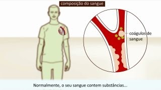 Trombose  Causa e tratamento [upl. by Dlawso]