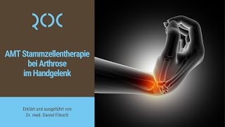 AMT Stammzellentherapie bei Arthrose im Handgelenk  ROC Aschheim [upl. by Jaquith4]