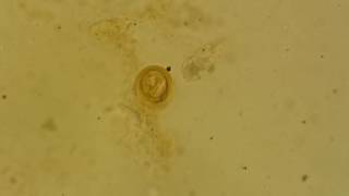 Fertilised decorticated egg of Ascaris lumbricoides [upl. by Etterraj820]