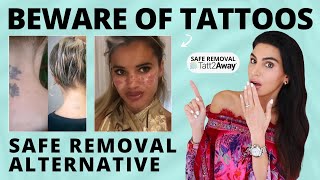 Laser Tattoo Removal Isn’t the Only Way to Remove Tattoos  Everything You Need to Know [upl. by Revolc]