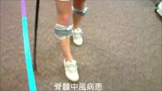 脊髓中風病患使用Walkaide Spinal Stroke using WalkAide [upl. by Alegnat563]