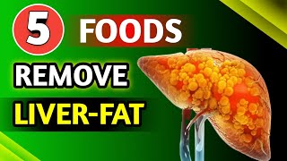 THIS REVERSES Fatty Liver In Just 14 Days Liver Detoxification Foods [upl. by Earle]