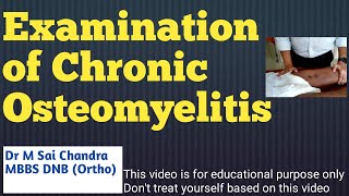 Examination Of Chronic Osteomyelitis [upl. by Wyn]