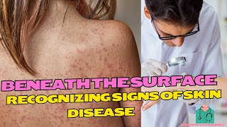 Beneath the Surface Recognizing Signs of Skin Diseases [upl. by Clifton21]