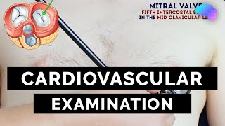 Cardiovascular Examination  OSCE Guide  UKMLA  CPSA [upl. by Catharine]