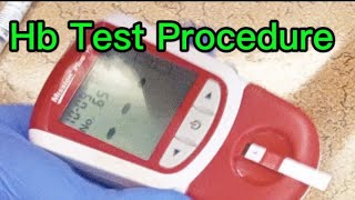 How to check hemoglobin level [upl. by Annael276]