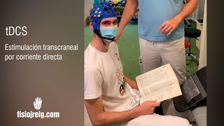 tDCS  Estimulación Transcraneal Eléctrica ¿En qué consiste [upl. by Muhan554]