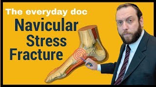 NAVICULAR STRESS FRACTURE THE EVERYDAY DOC [upl. by Nikki]