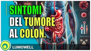 Sintomi del Tumore al Colon [upl. by Feinstein]