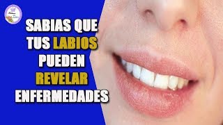 Tus labios pueden revelar enfermedades [upl. by Jemmie]