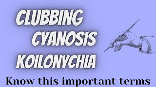 ClubbingCyanosisKoilonychia [upl. by Chamberlin]