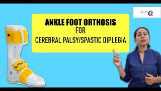 Things you should know about ANKLE FOOT ORTHOSIS [upl. by Olecram]