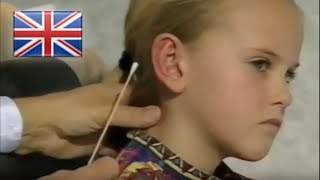 Dr Waldemar Merck Ear Surgery Ear Pinning Ear Correction Otoplasty [upl. by Elias]