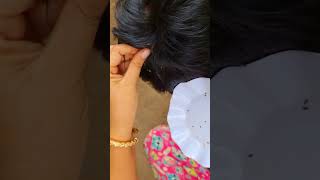 Itchy Scalp Satisfying And Picking Lice 5 [upl. by Wayne50]