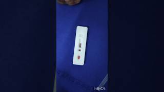 Malaria test in emergency ward emergency duty hospital nursing doctor subscribe mbbs [upl. by Ahsitnauq]